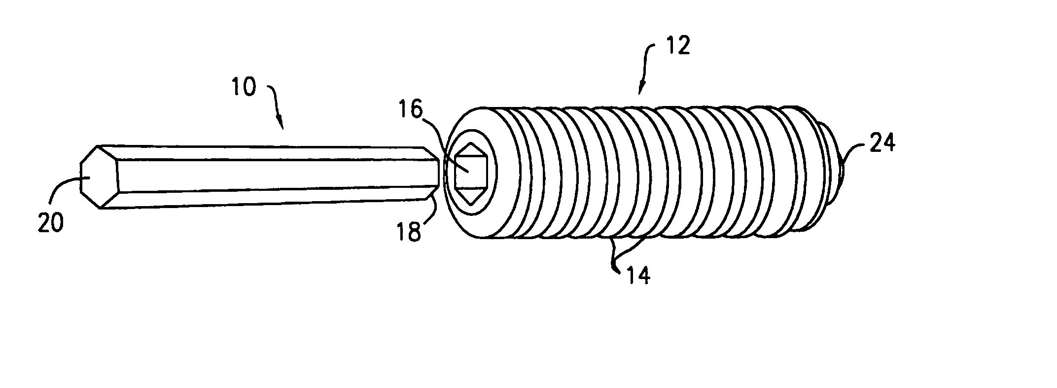 Polymer-based orthopedic screw and driver system with increased insertion torque tolerance and associated method for making and using same