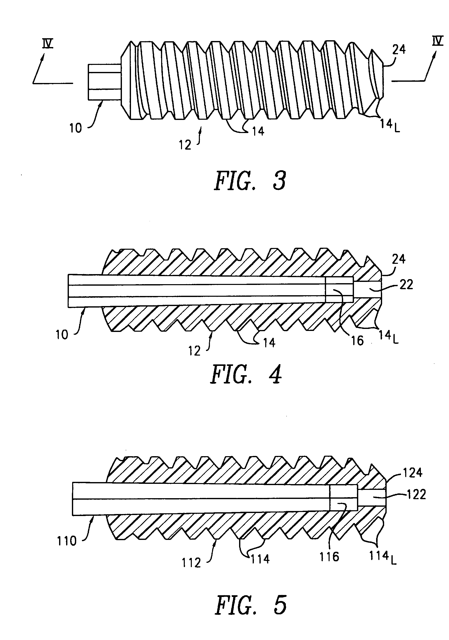 Polymer-based orthopedic screw and driver system with increased insertion torque tolerance and associated method for making and using same