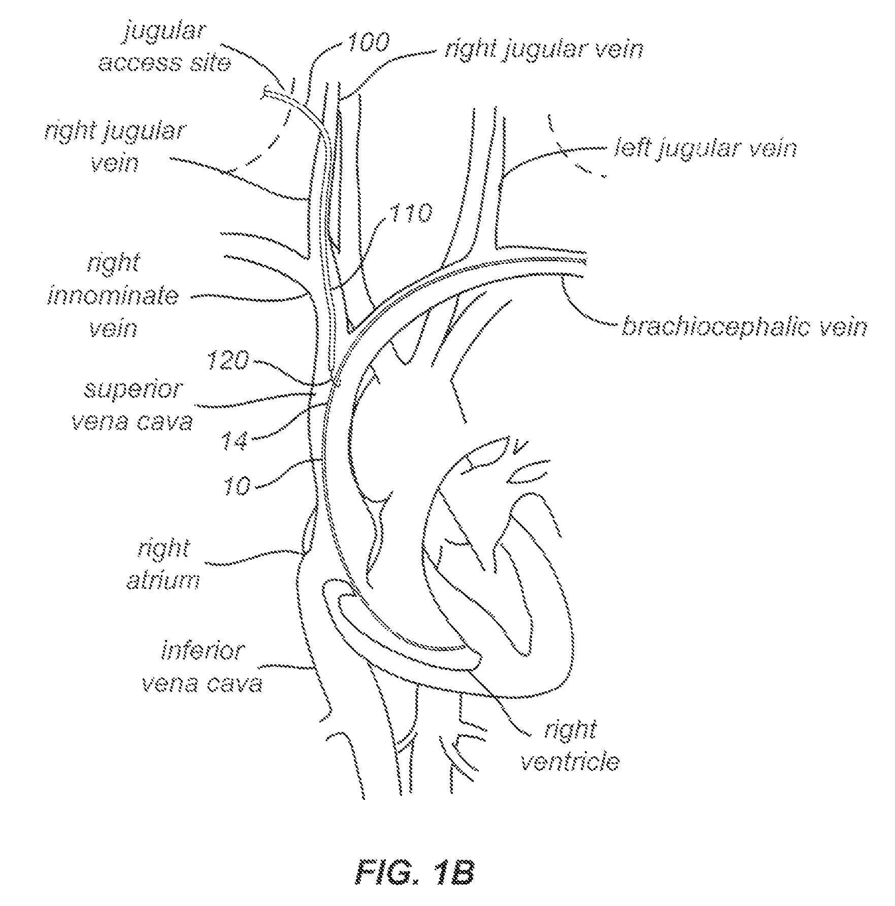 Snaring systems and methods