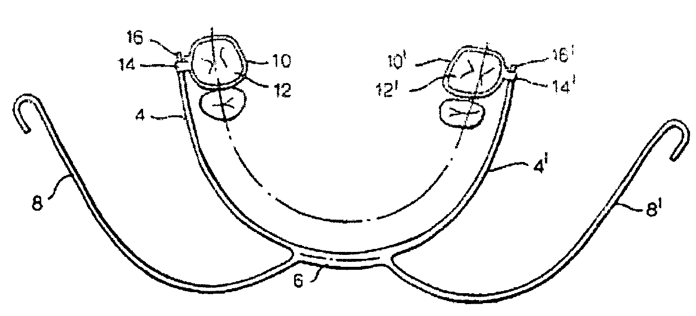 Orthodontic facebow