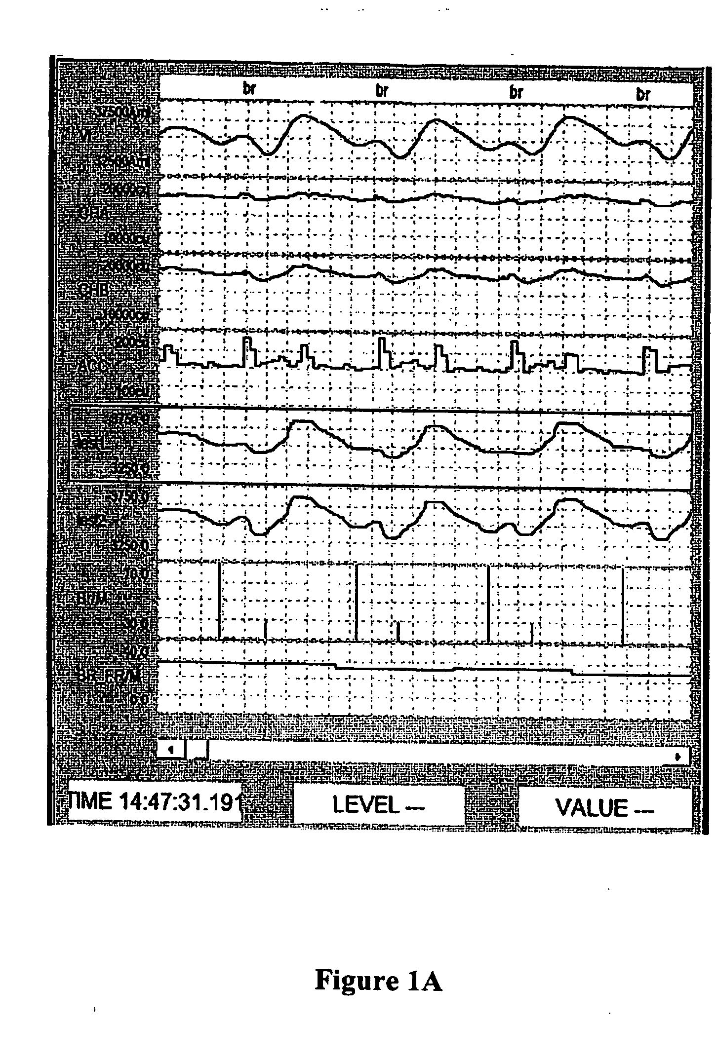 Methods and systems for real time breath rate determination with limited processor resources