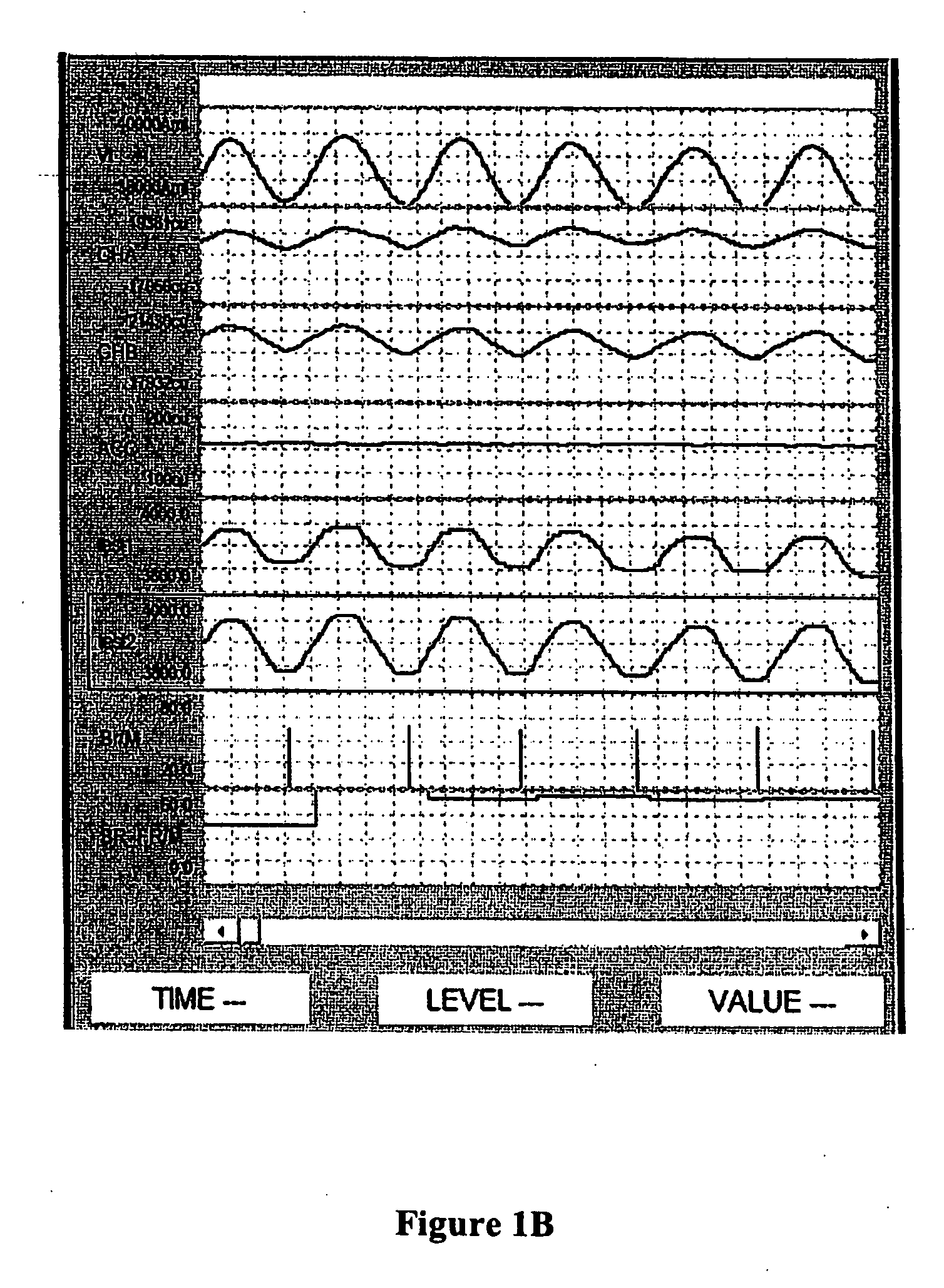 Methods and systems for real time breath rate determination with limited processor resources