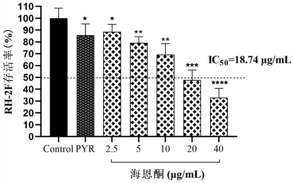 Application of hycanthone in preparation of medicine for treating toxoplasma gondii infection diseases