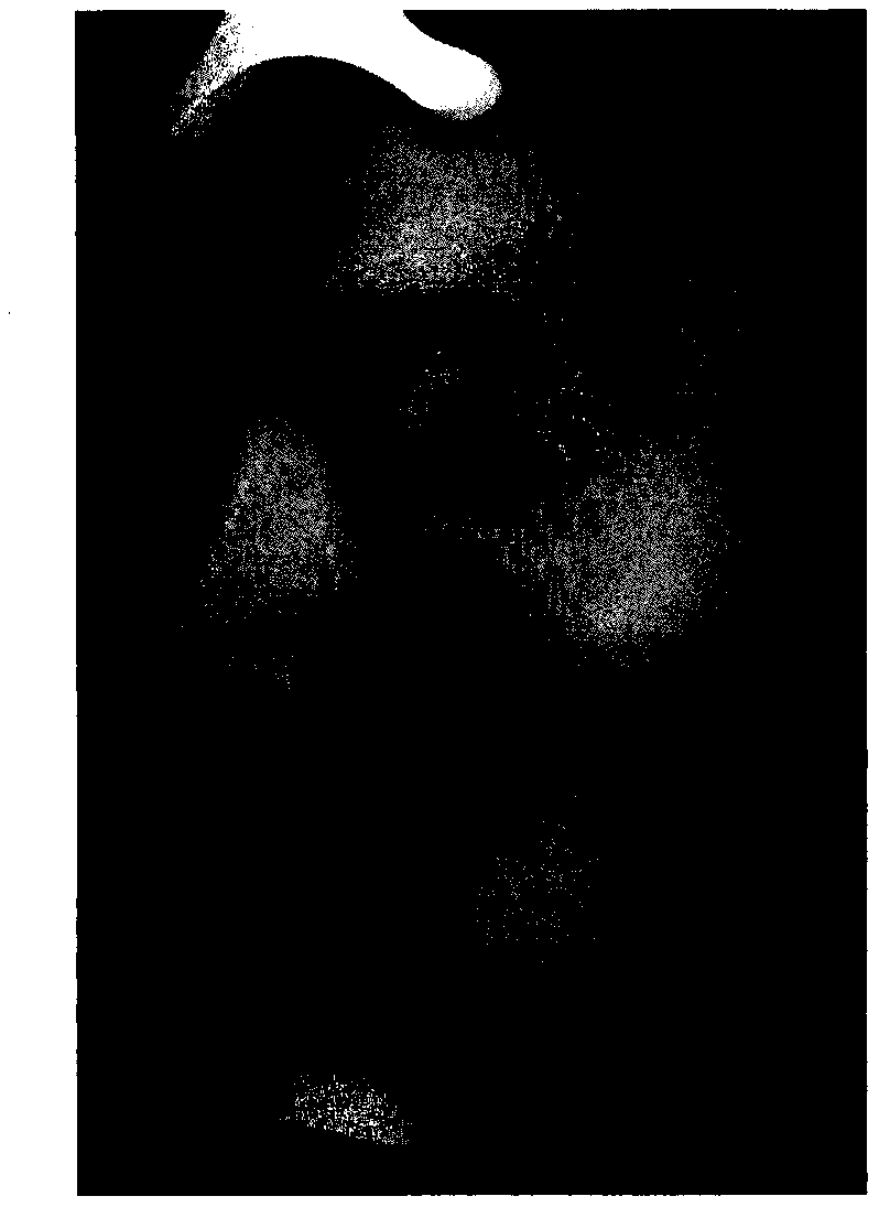 Method for automatically identifying facial skin wrinkles and automatically grading wrinkle severity