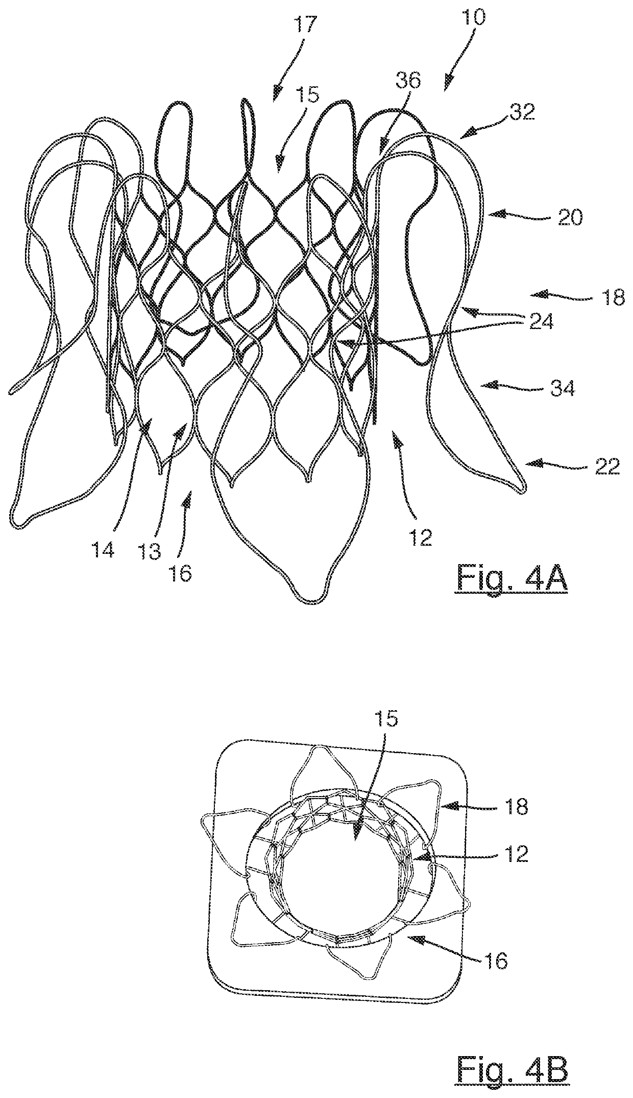 Stent device for a prosthetic heart valve