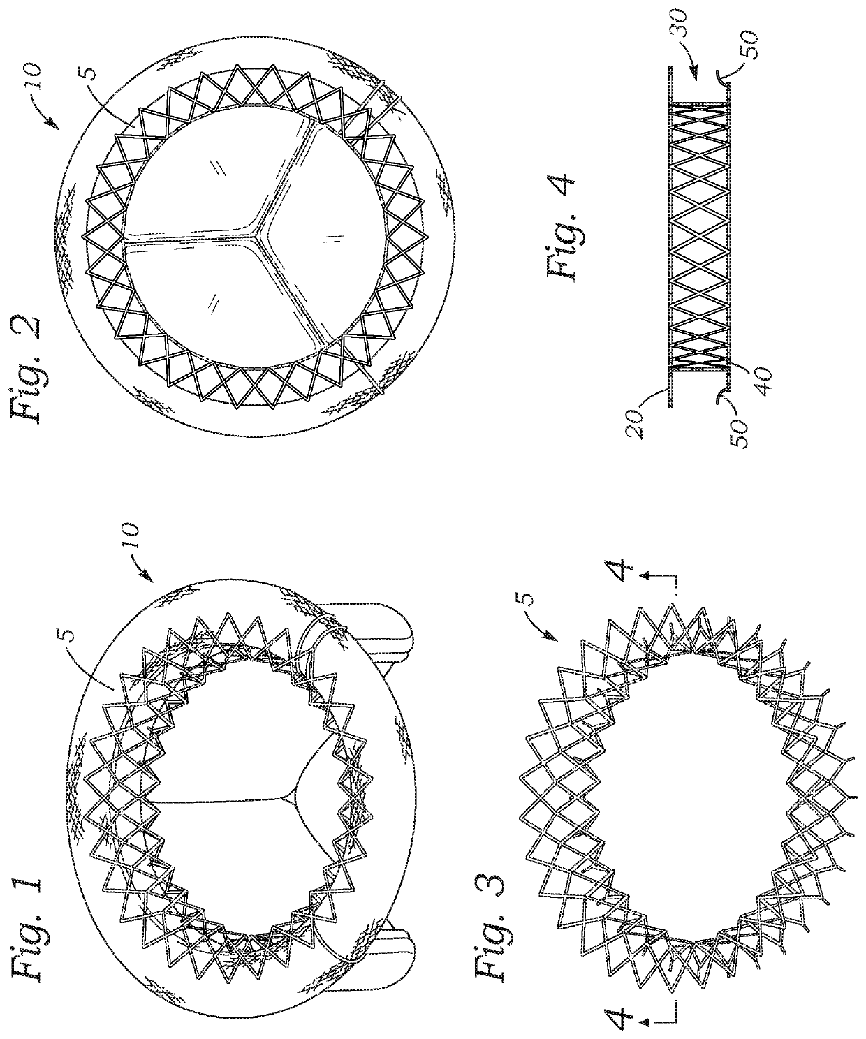 Methods for securing a transcatheter valve to a bioprosthetic cardiac structure
