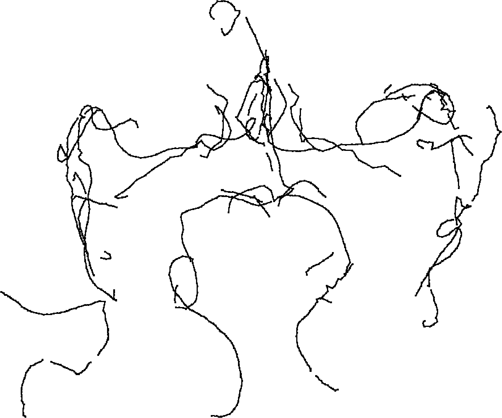 Method for constructing three-dimensional blood vessel model based on ball B-spline curve