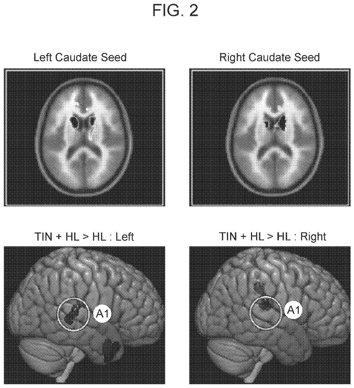 Multimodal Neuroimaging-Based Diagnostic Systems and Methods for Detecting Tinnitus
