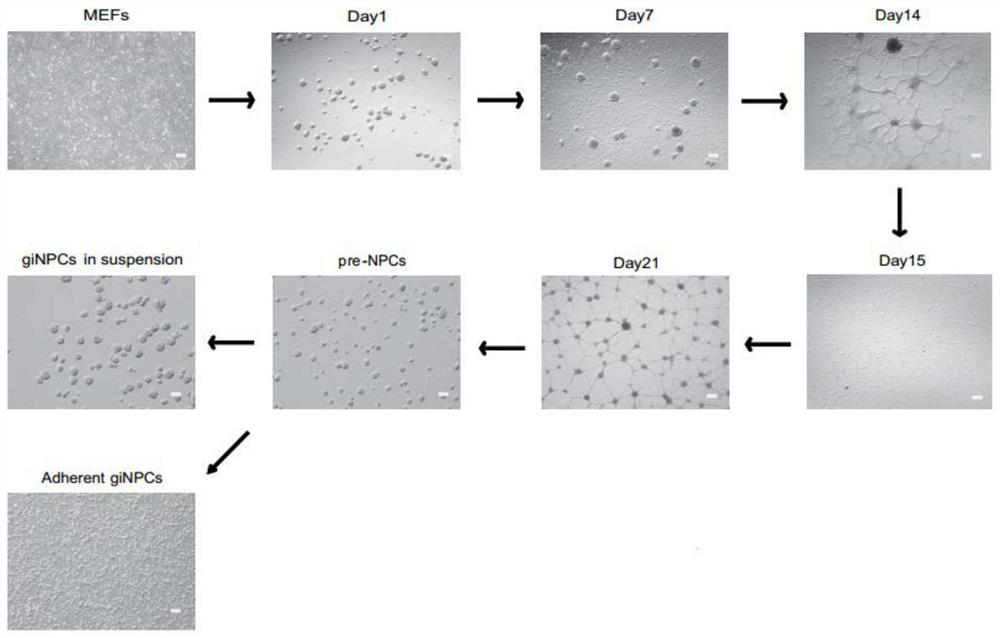 Method for Inducing Growth Factors to Generate Neural Precursor Cells