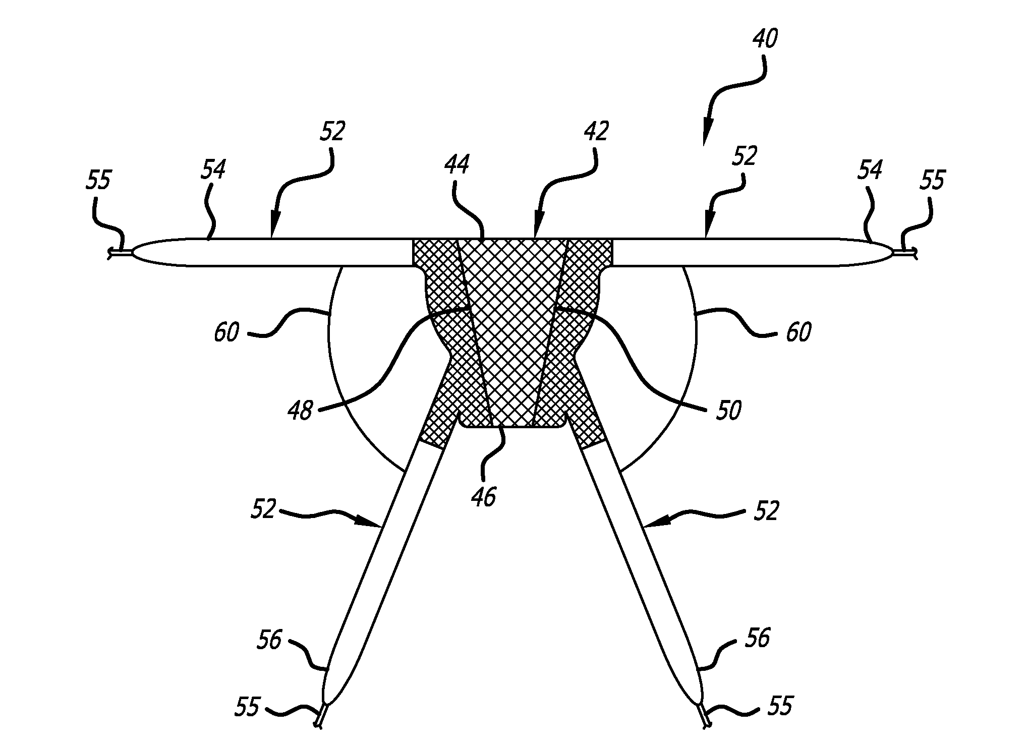 Implants And Procedures For Treatment Of Pelvic Floor Disorders