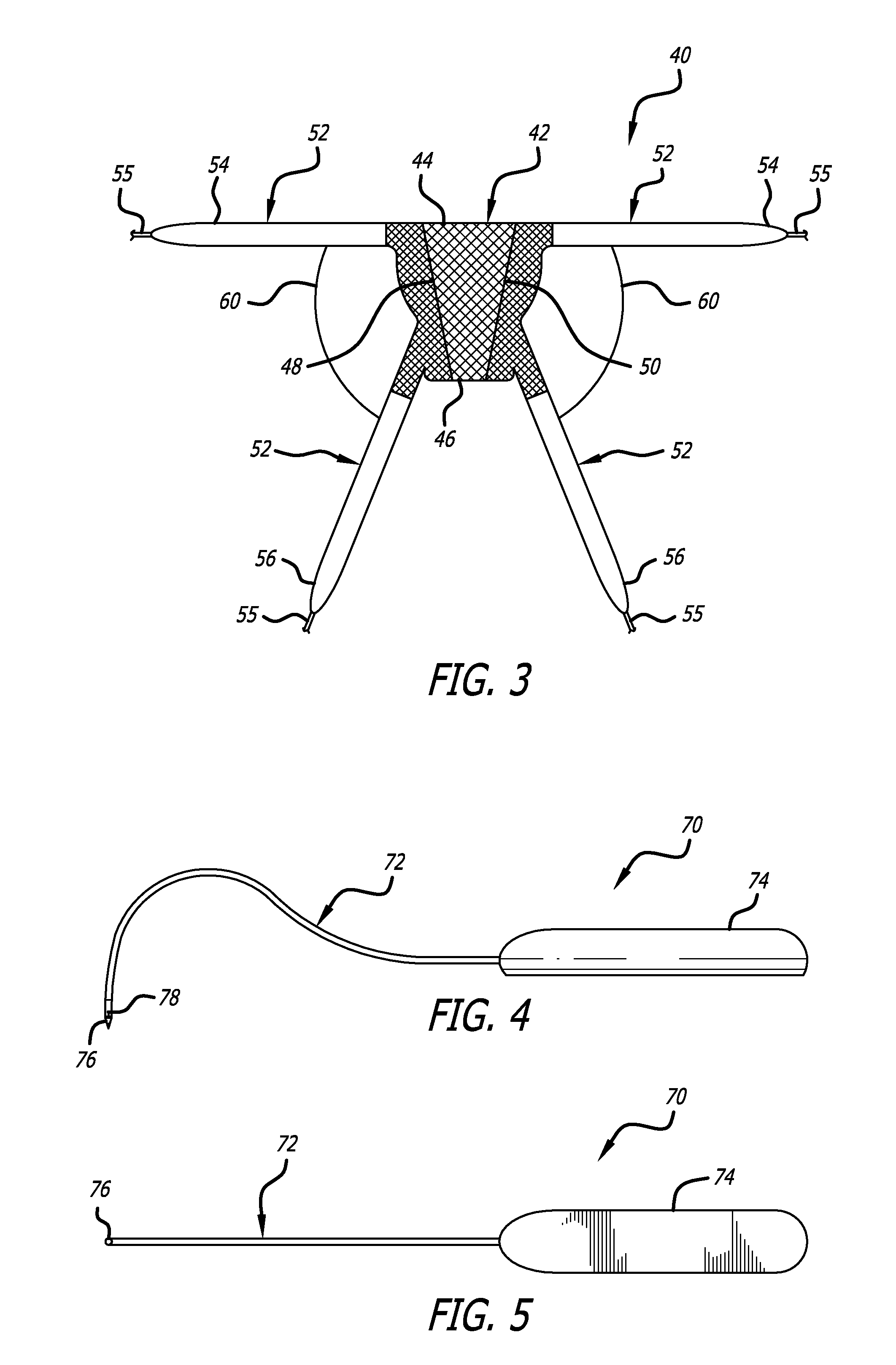 Implants And Procedures For Treatment Of Pelvic Floor Disorders