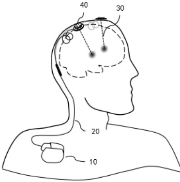 Electrical lead, processing method, extension cord, electrode and electrical stimulation system