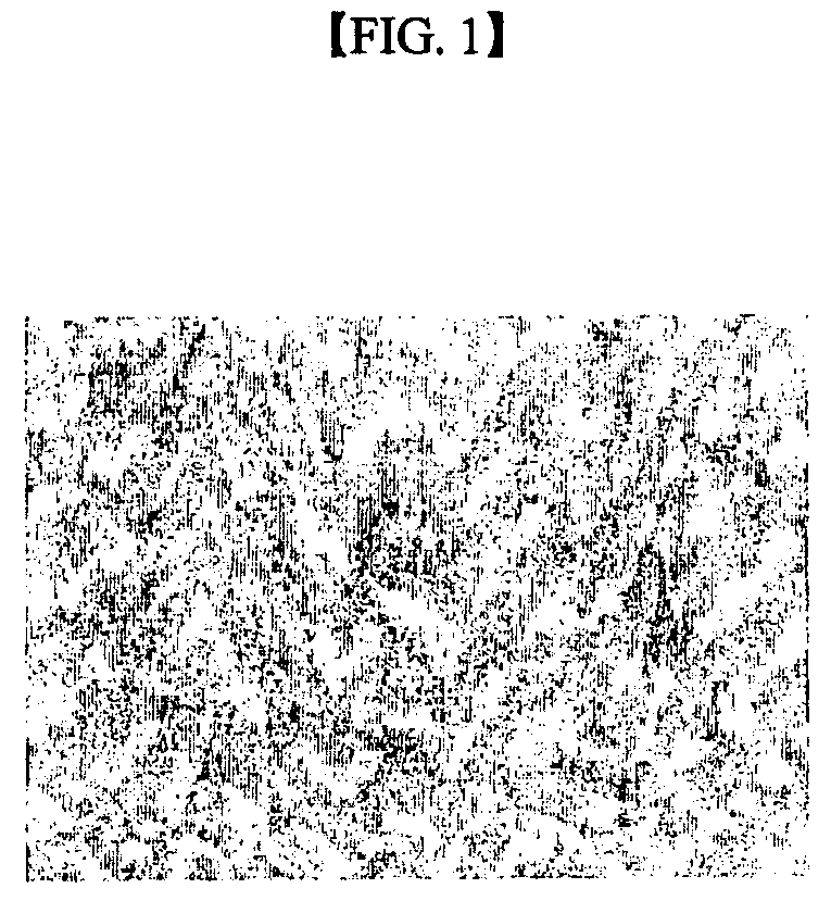 Method for differentiating mesenchymal stem cell into neural cell and pharmaceutical composition containing the neural cell for neurodegenerative disease