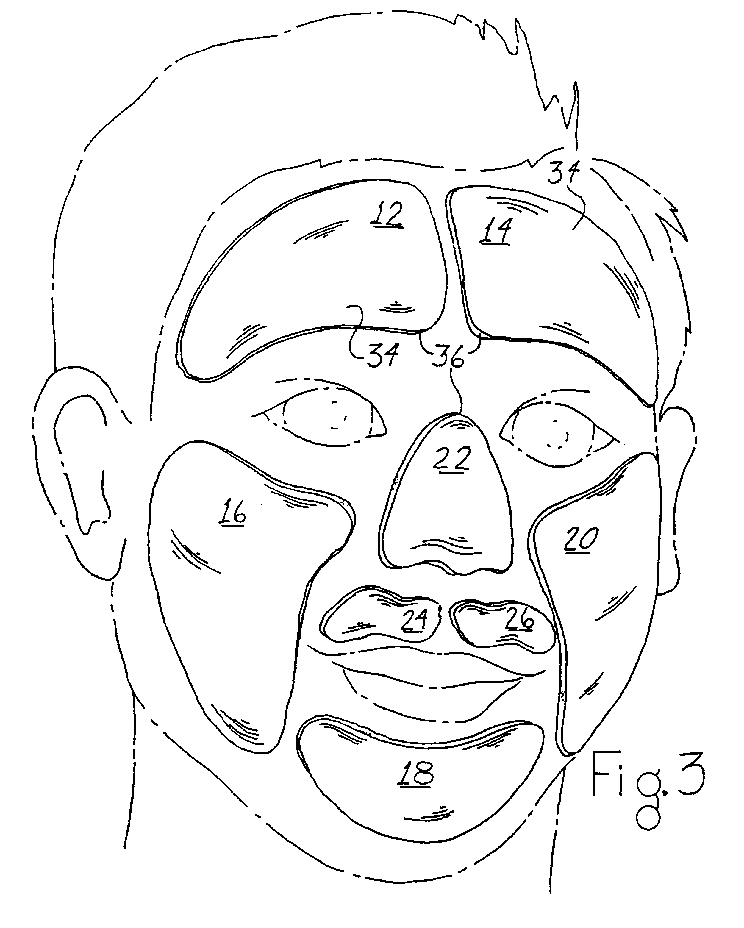 Segmental face mask