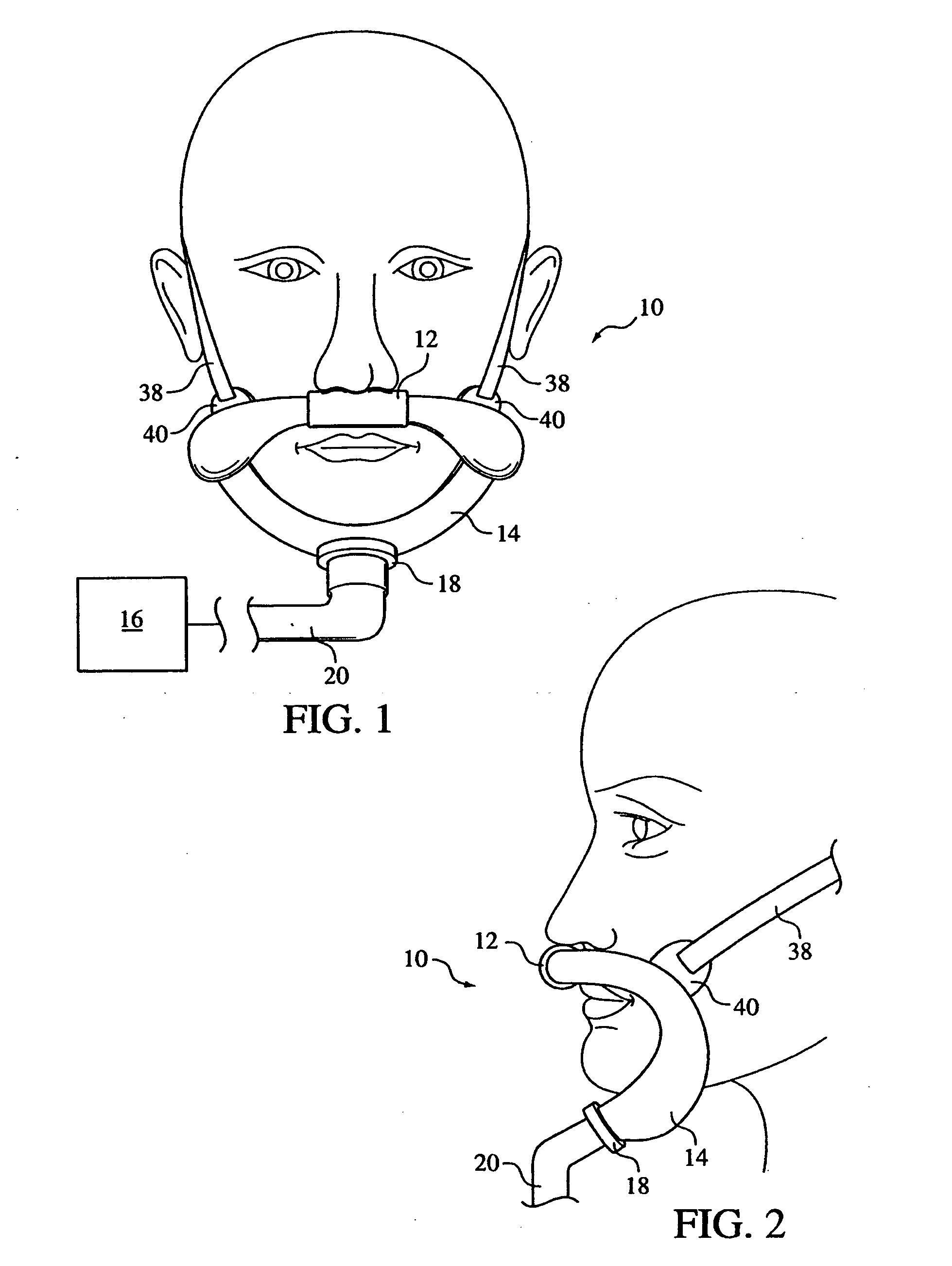 Patient intreface assembly supported under the mandible