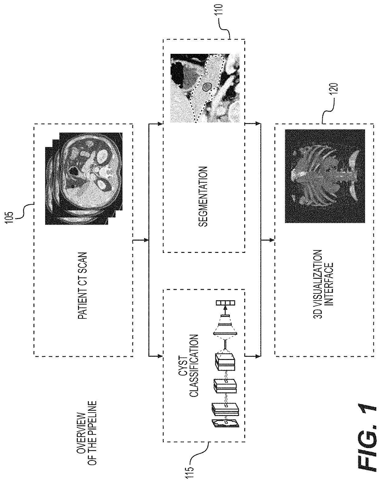 System, method, and computer-accessible medium for virtual pancreatography