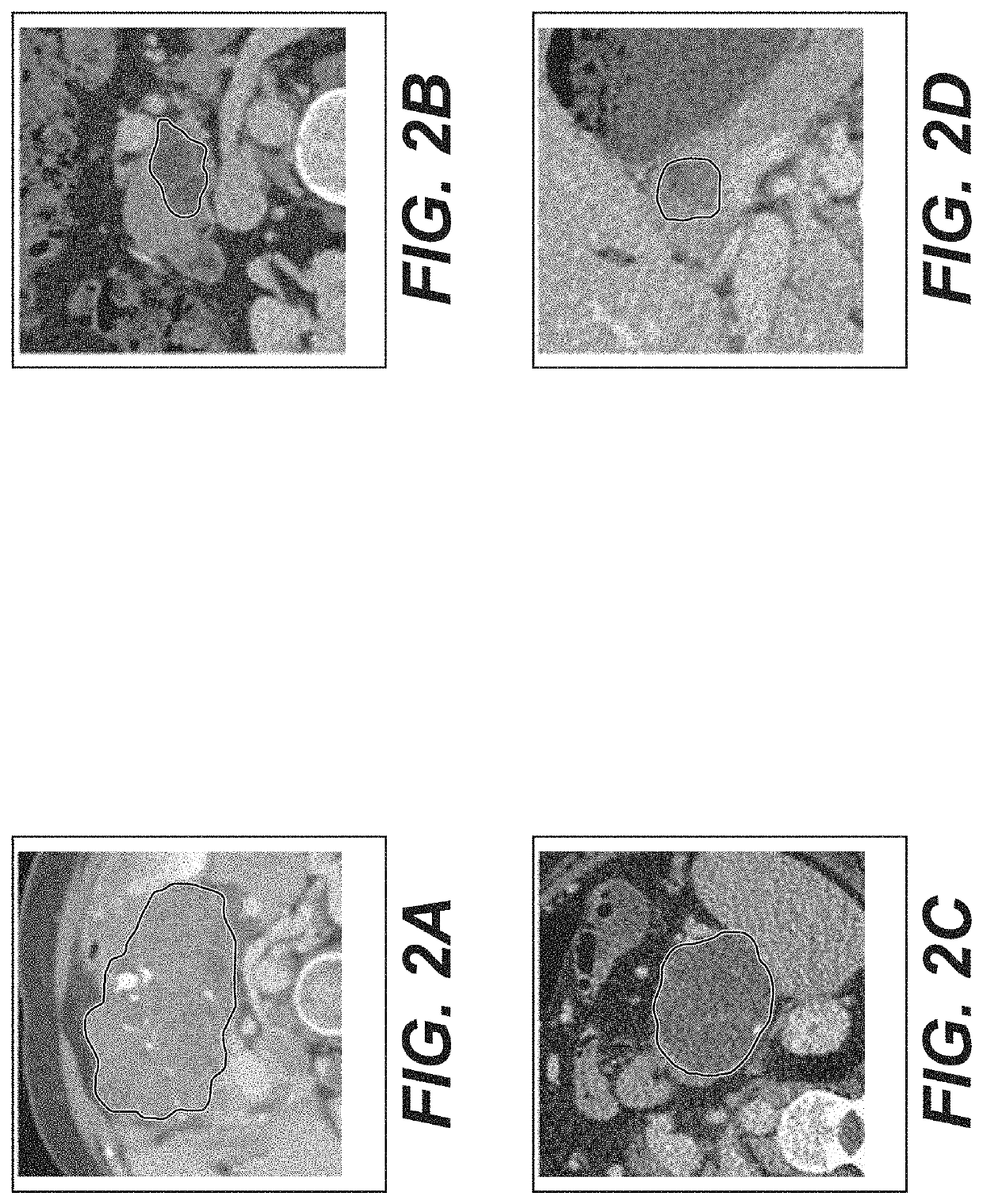 System, method, and computer-accessible medium for virtual pancreatography