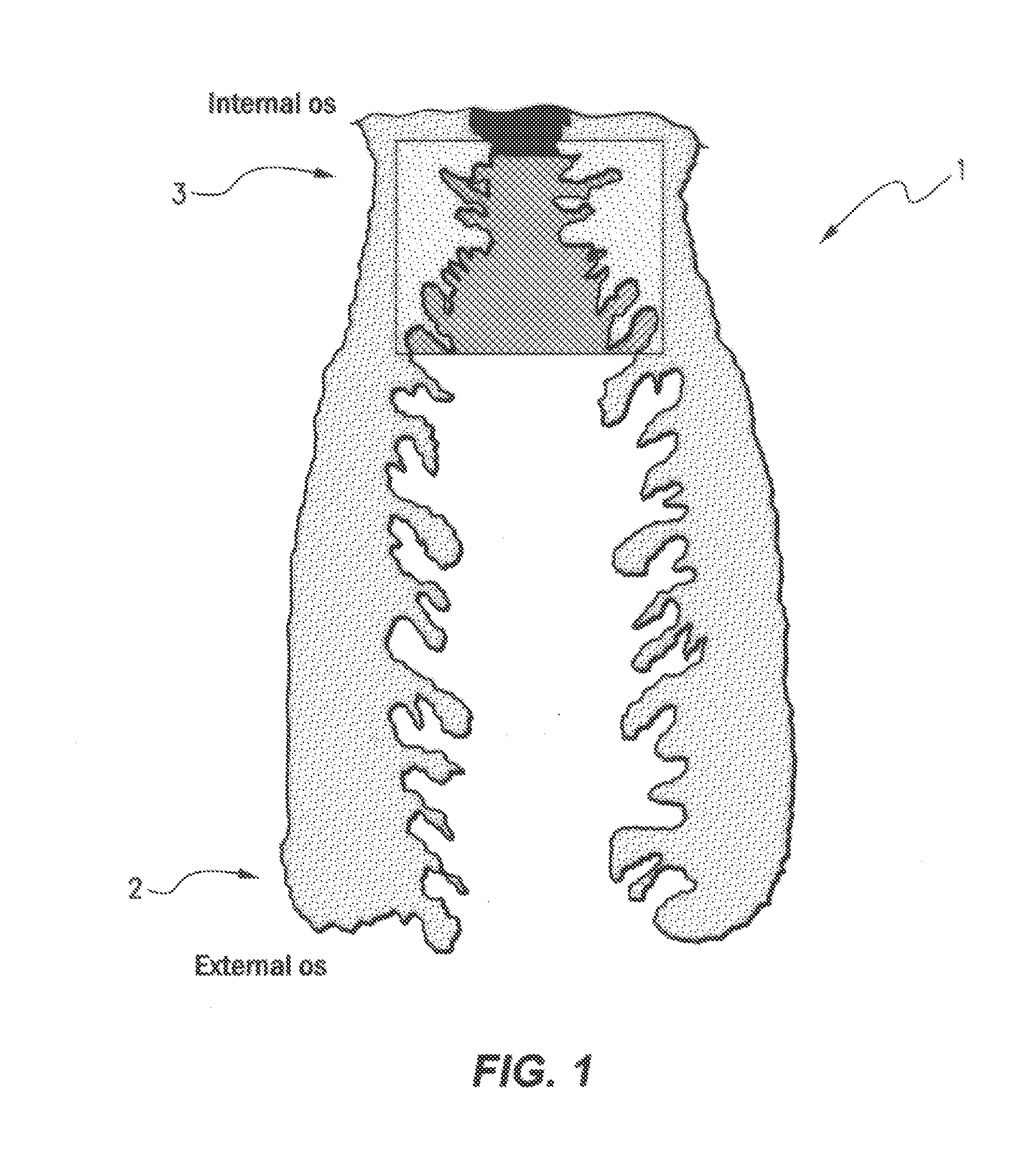 Biological sampling device