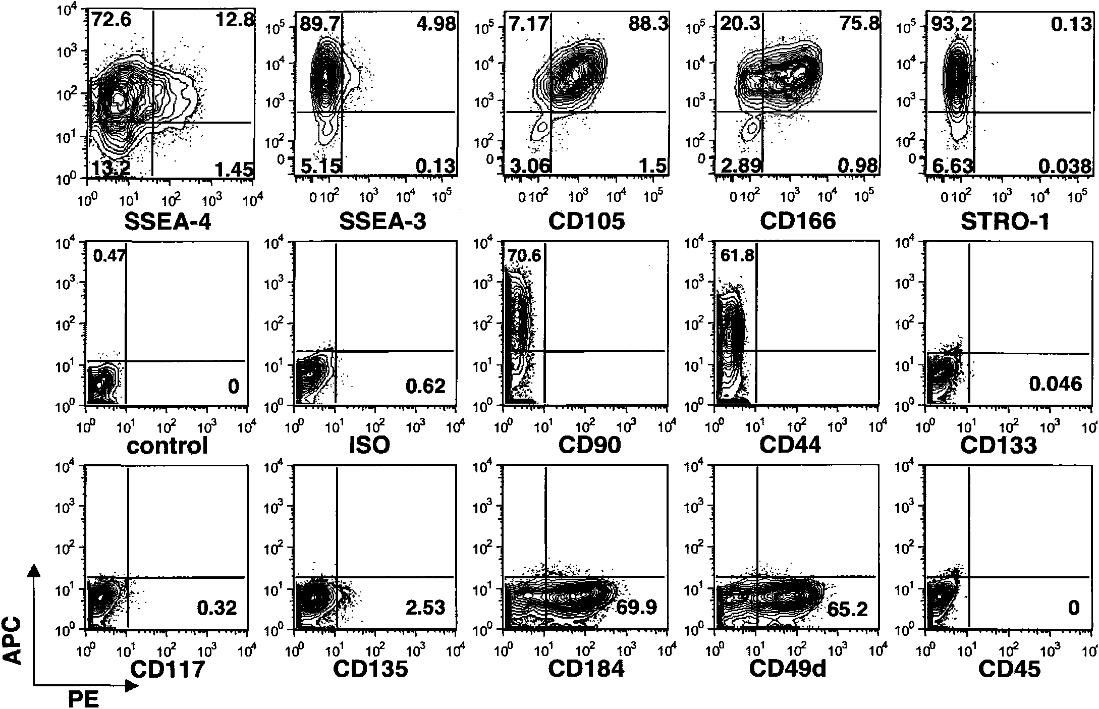 Human osteosarcoma stem-cell related antigenic marker and application thereof