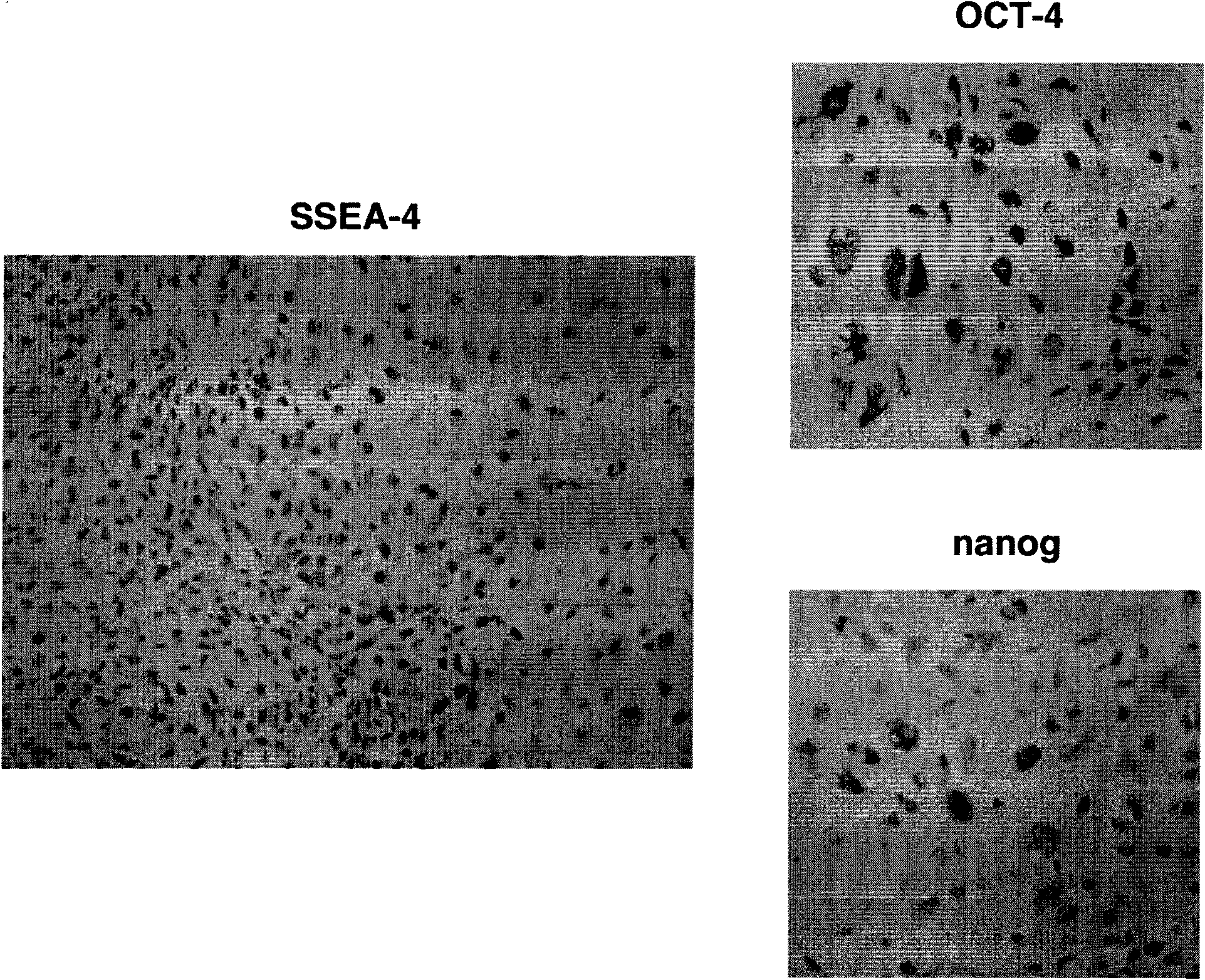 Human osteosarcoma stem-cell related antigenic marker and application thereof