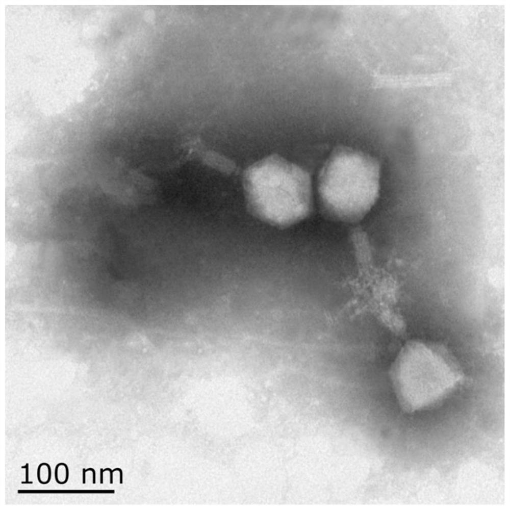 Enterobacter hormaechei bacteriophage YZU.P.A-5 and application thereof