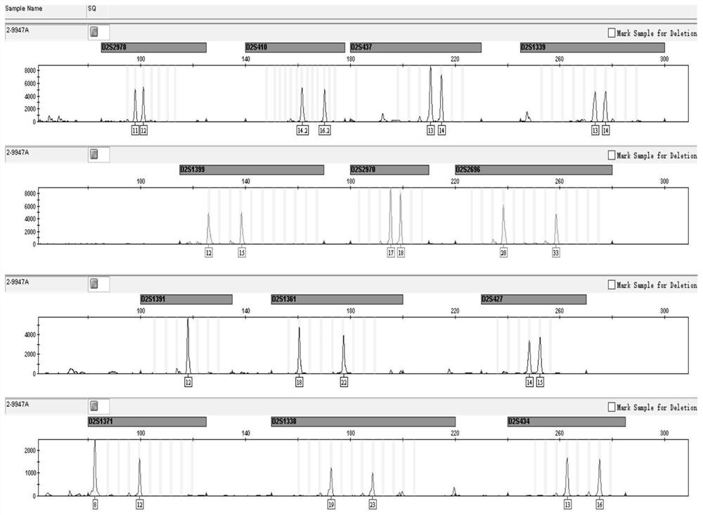Composite amplification detection system for linked STR gene loci on human chromosomes I and II and application of composite amplification detection system