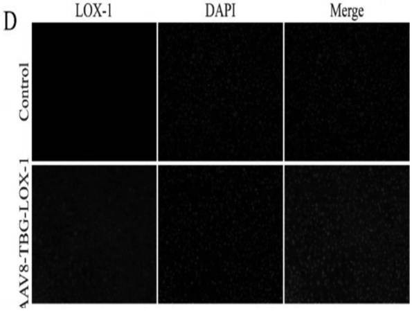 Recombinant adeno-associated virus vector for treating atherosclerosis, gene composition and application