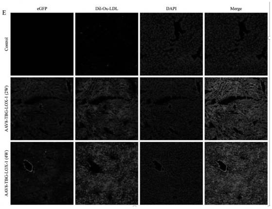 Recombinant adeno-associated virus vector for treating atherosclerosis, gene composition and application