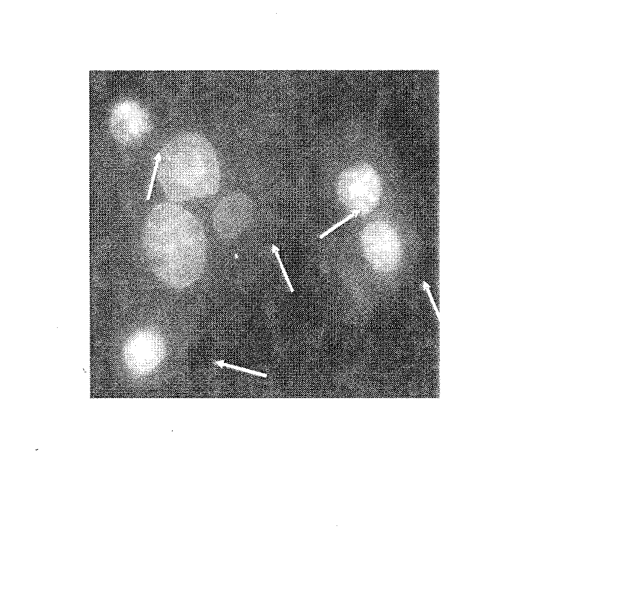 Method for preventing or attenuating anthracycline-induced cardiotoxicity