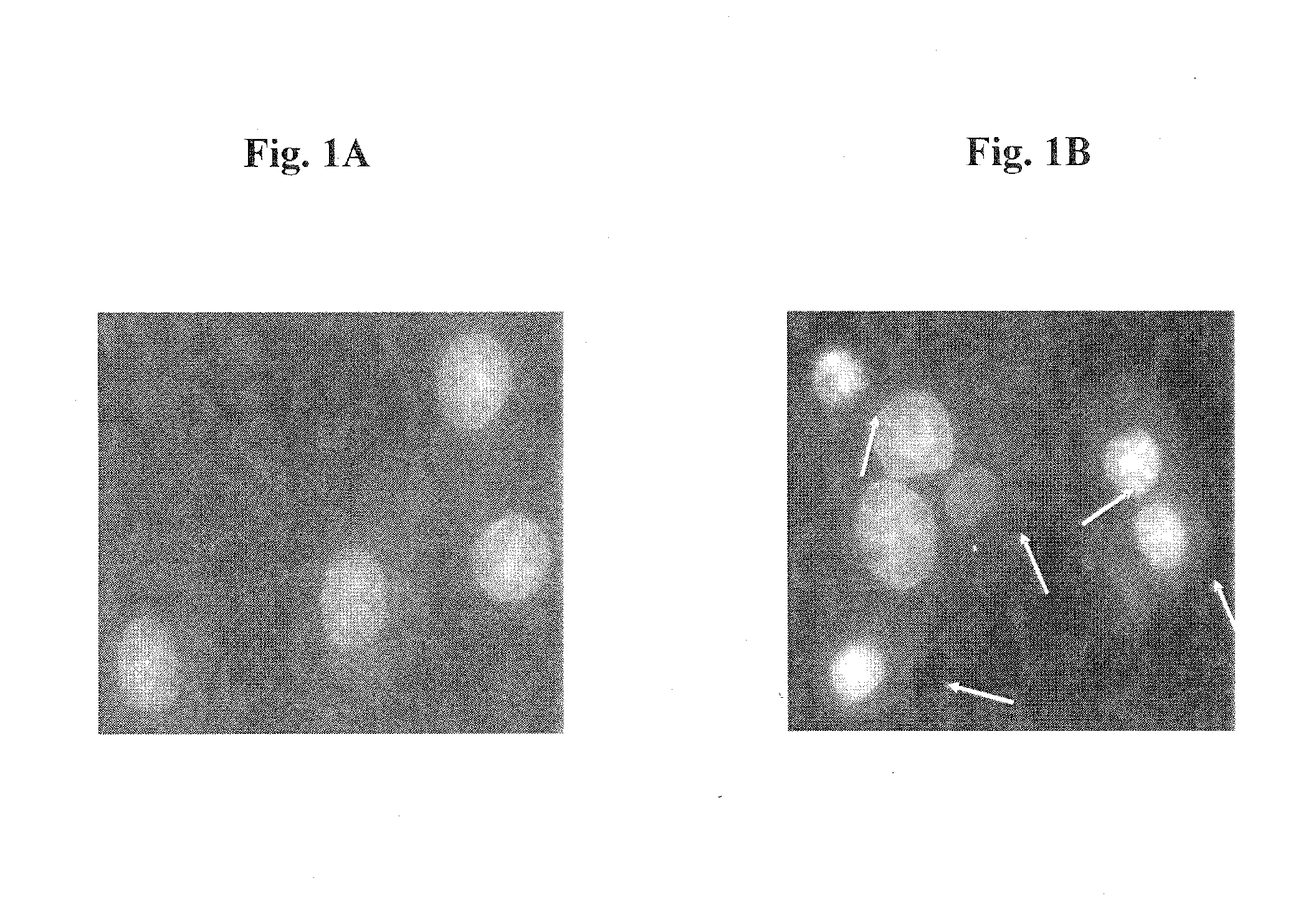 Method for preventing or attenuating anthracycline-induced cardiotoxicity