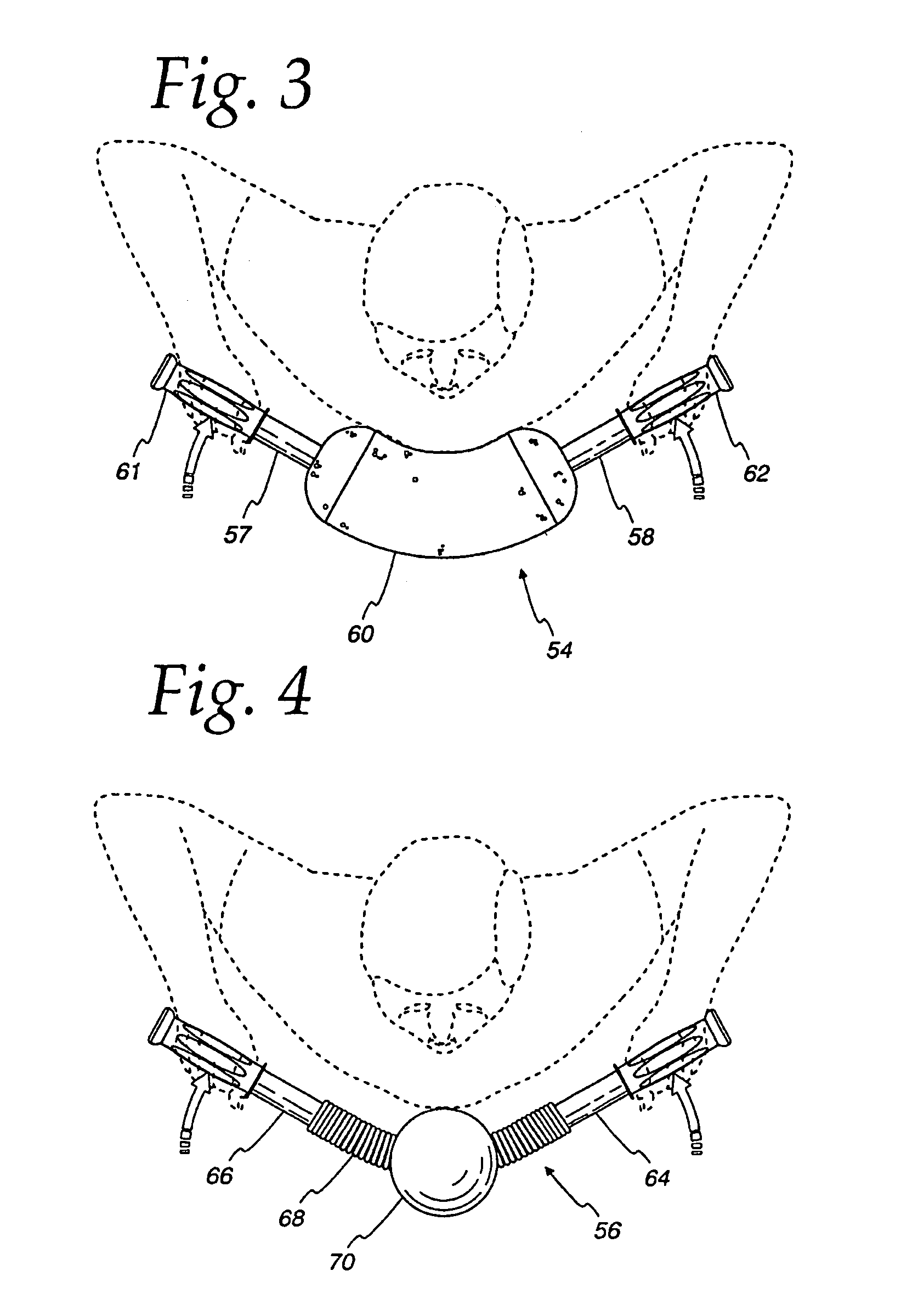 Exercise device and methods