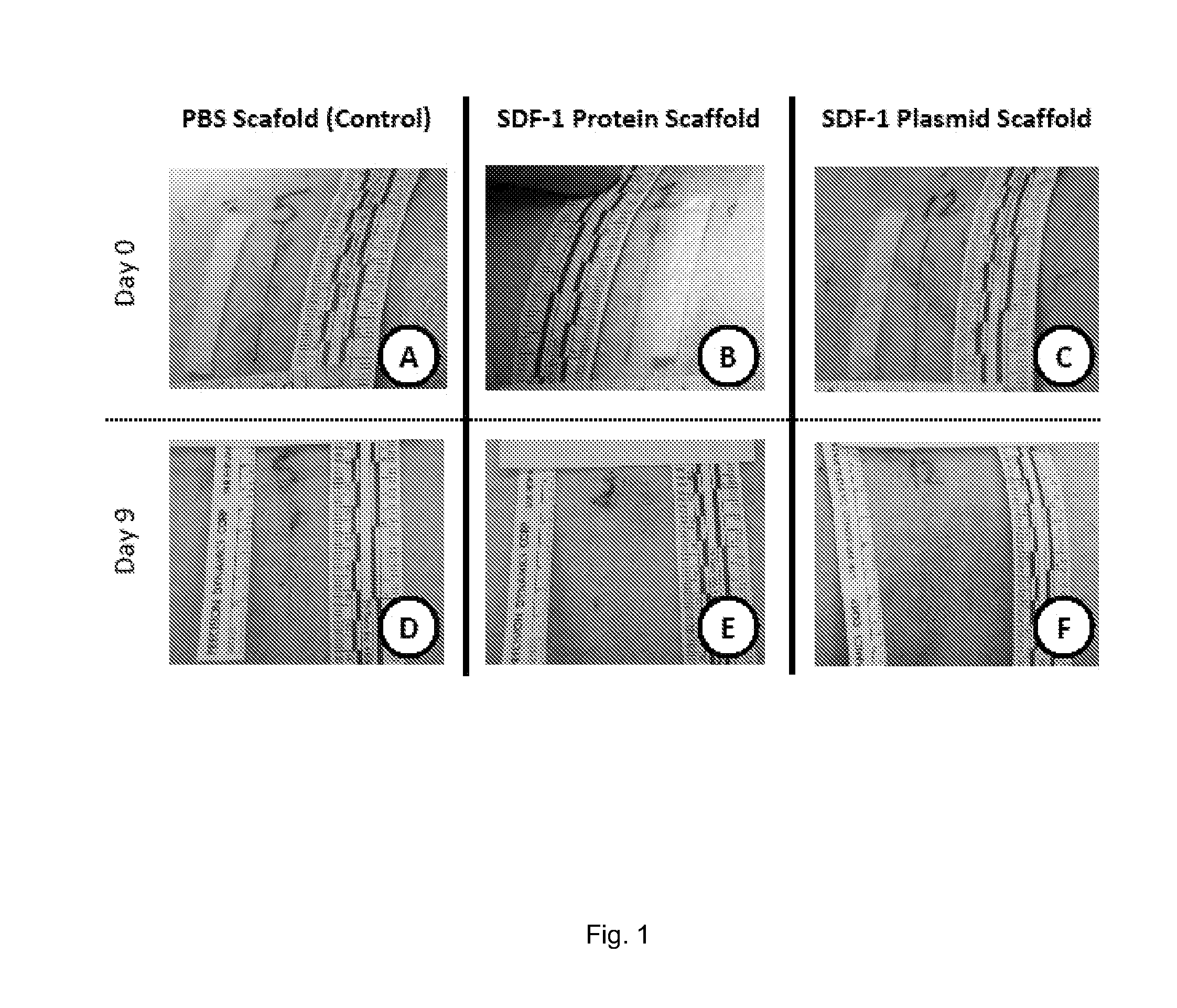 Compositions and methods of promoting wound healing