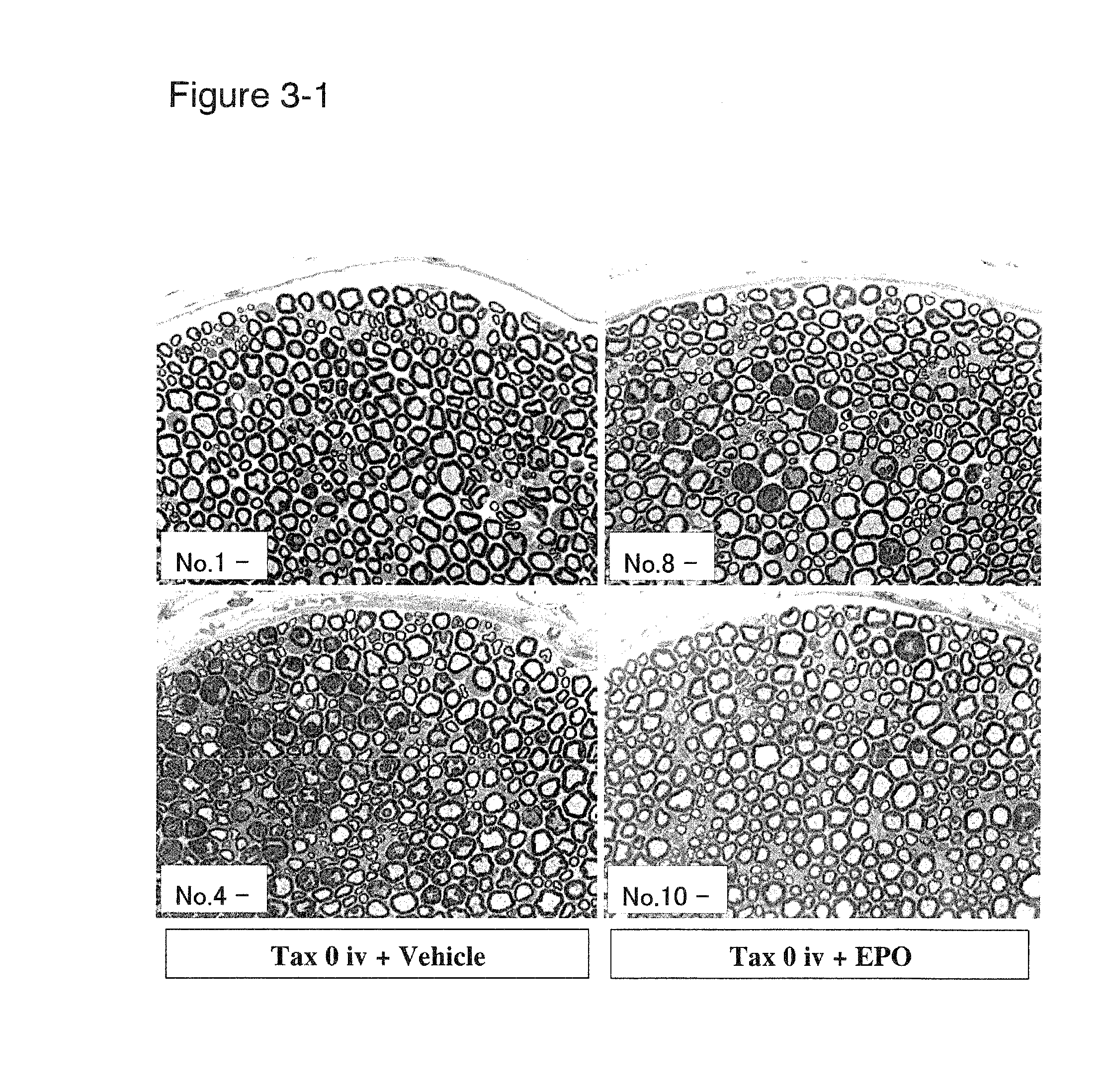 Prophylactic and/or therapeutic agents for peripheral neuropathy