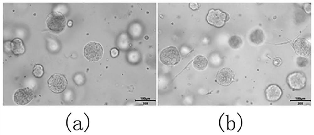 A kind of cryopreservation liquid and its preparation method and application