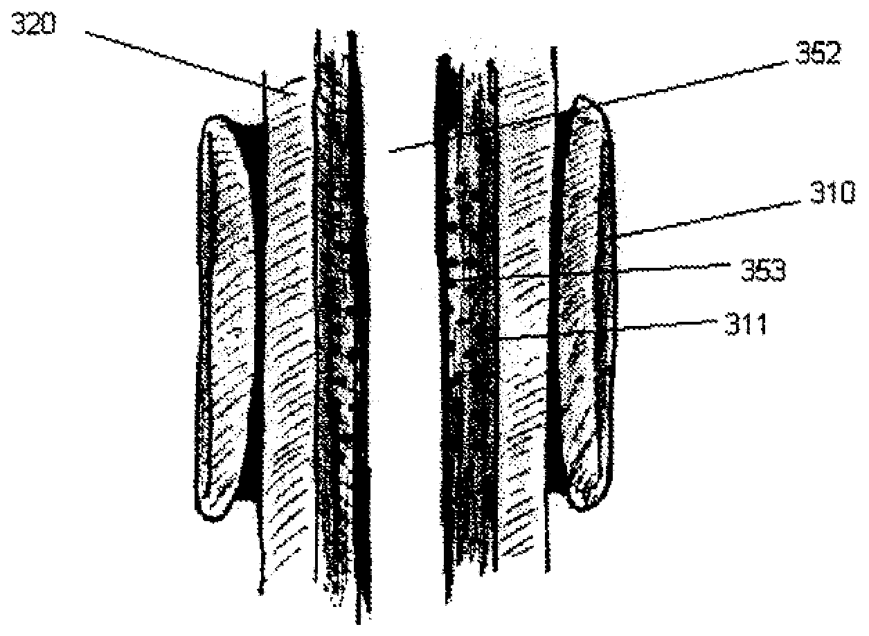 Devices and Methods for Magnetic Tissue Support