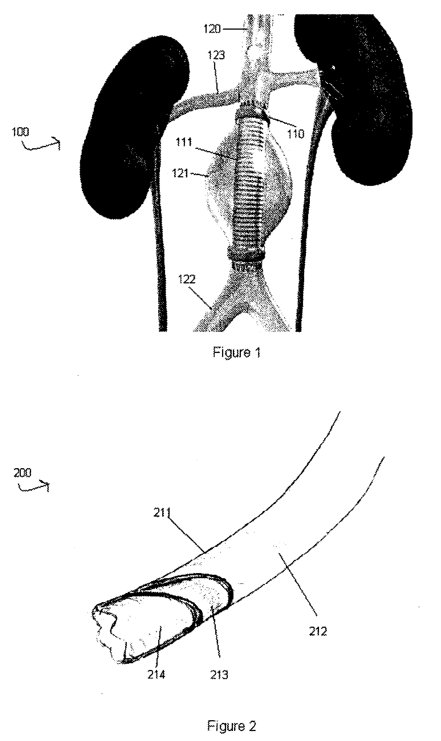 Devices and Methods for Magnetic Tissue Support