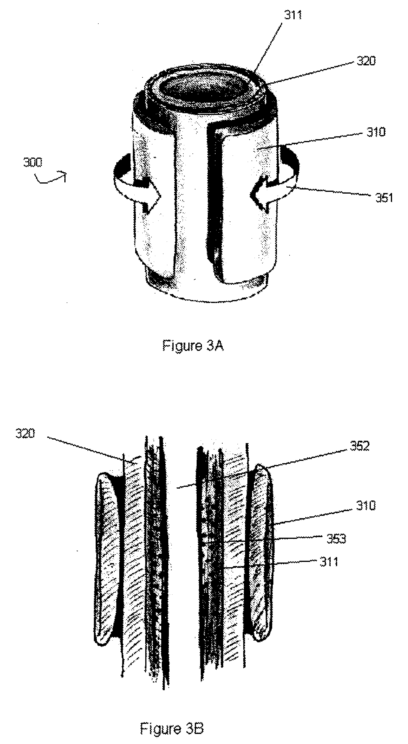 Devices and Methods for Magnetic Tissue Support