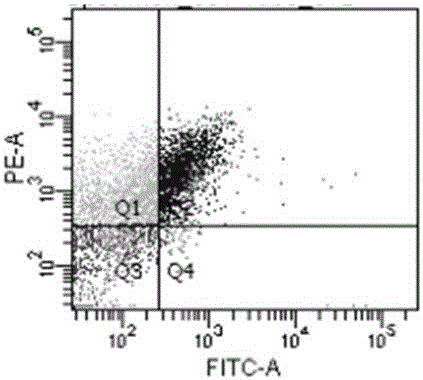 Brucella Omp16 protein antigen epitope polypeptides and application thereof