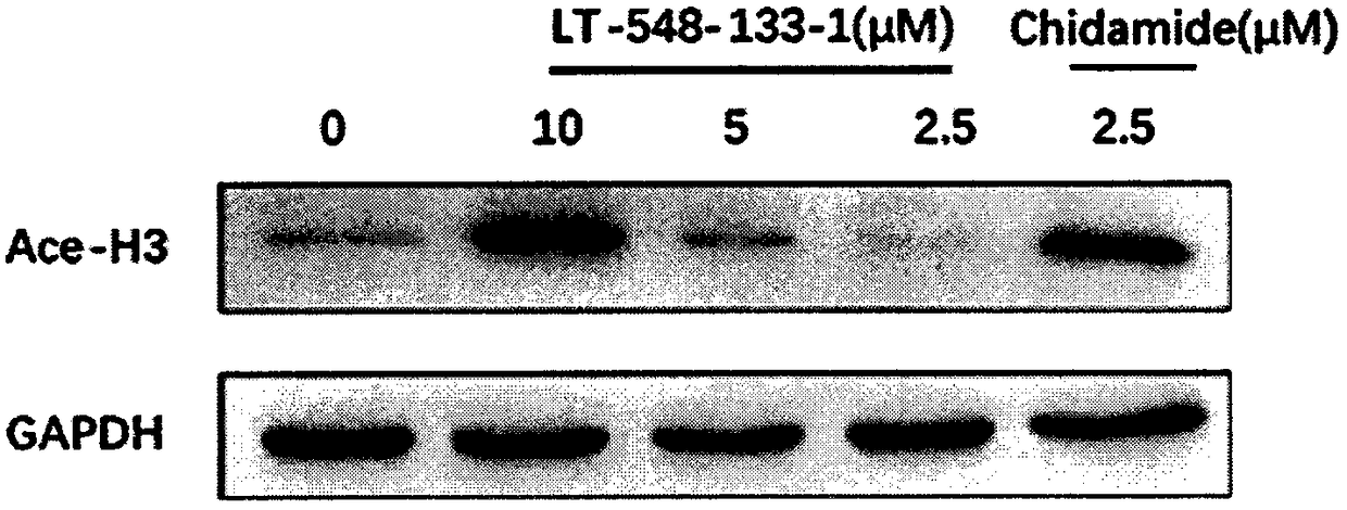 Use of chidamide analogue in preparation of anti-tumor drug