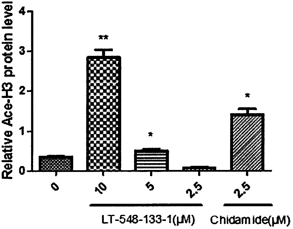 Use of chidamide analogue in preparation of anti-tumor drug
