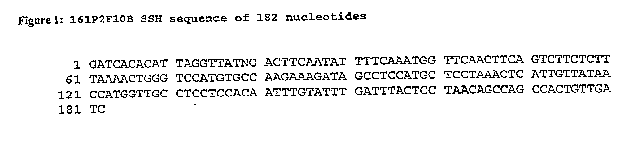 Nucleic acid and corresponding protein entitled 161P2F10B useful in treatment and detection of cancer