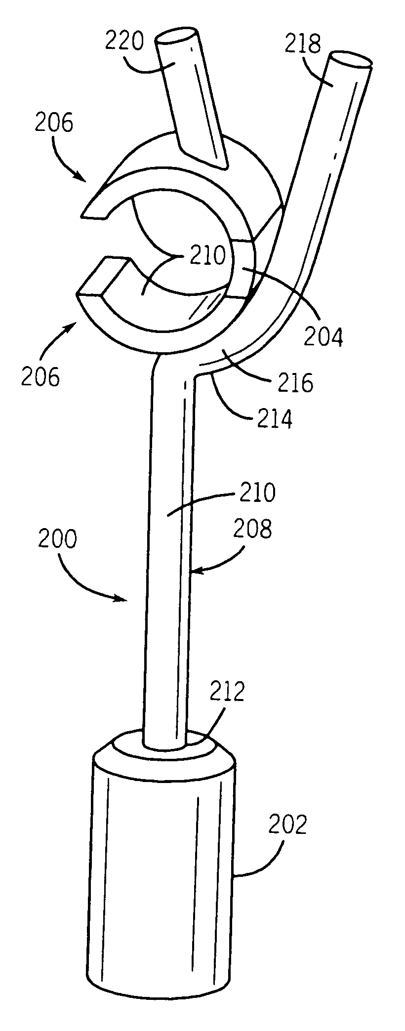 Attachment mechanism for middle ear prosthesis