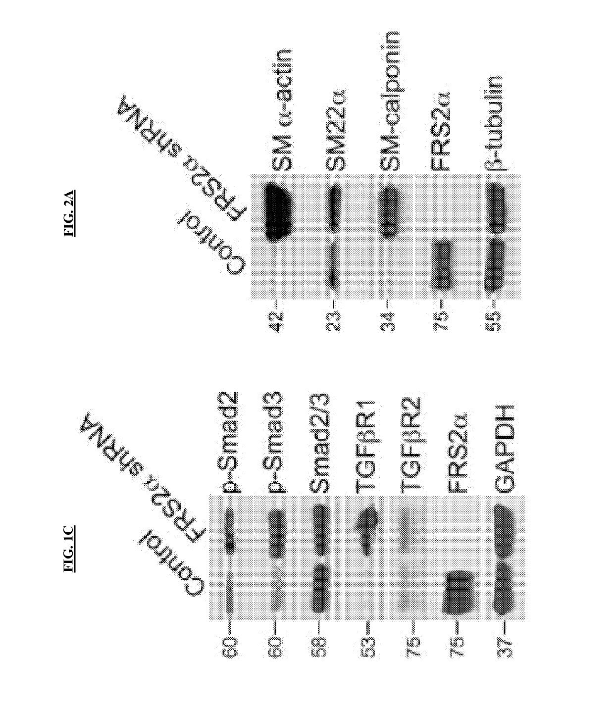 Methods and compositions for treating atherosclerosis