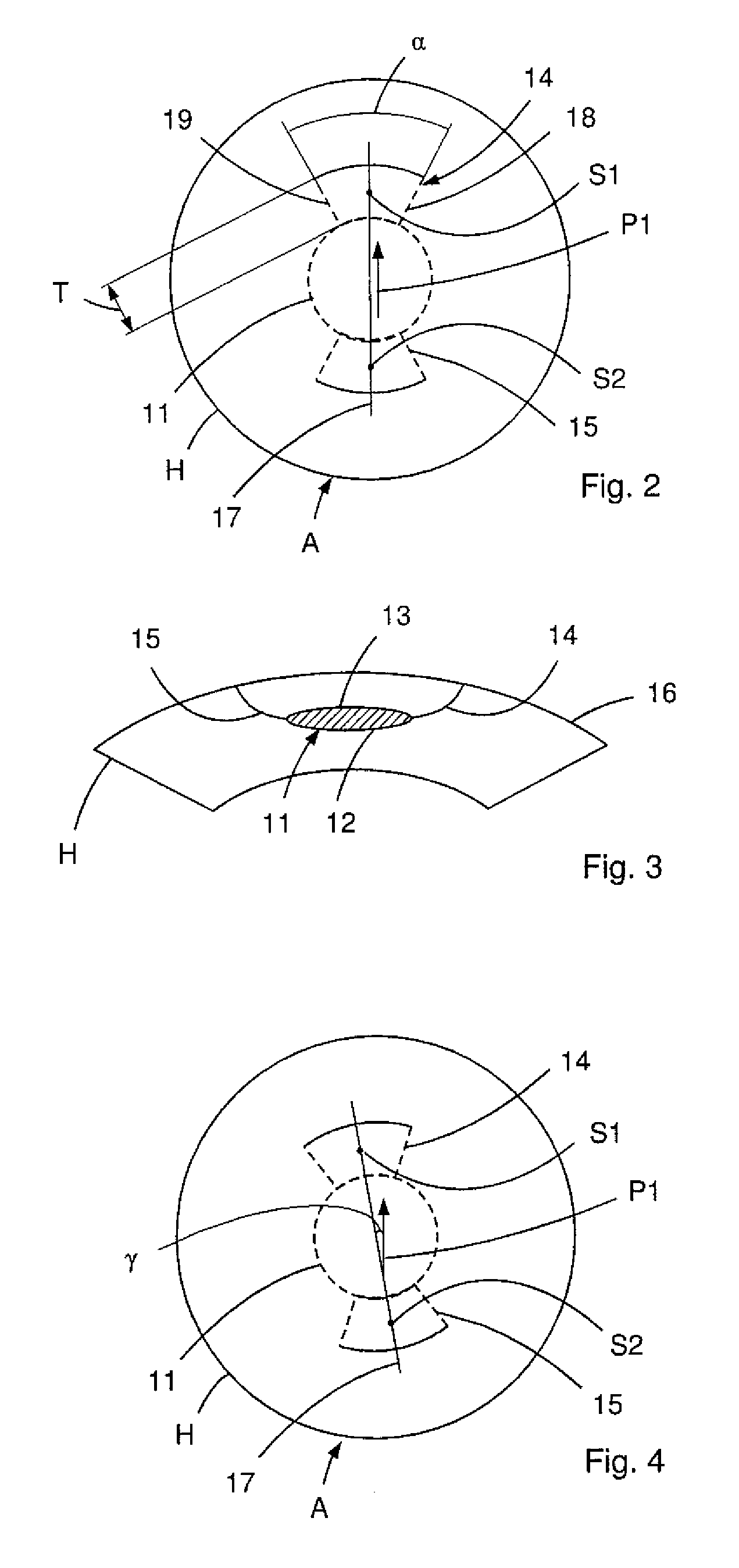 Apparatus and method for generating cut surfaces in the cornea of an eye for correction of ametropia
