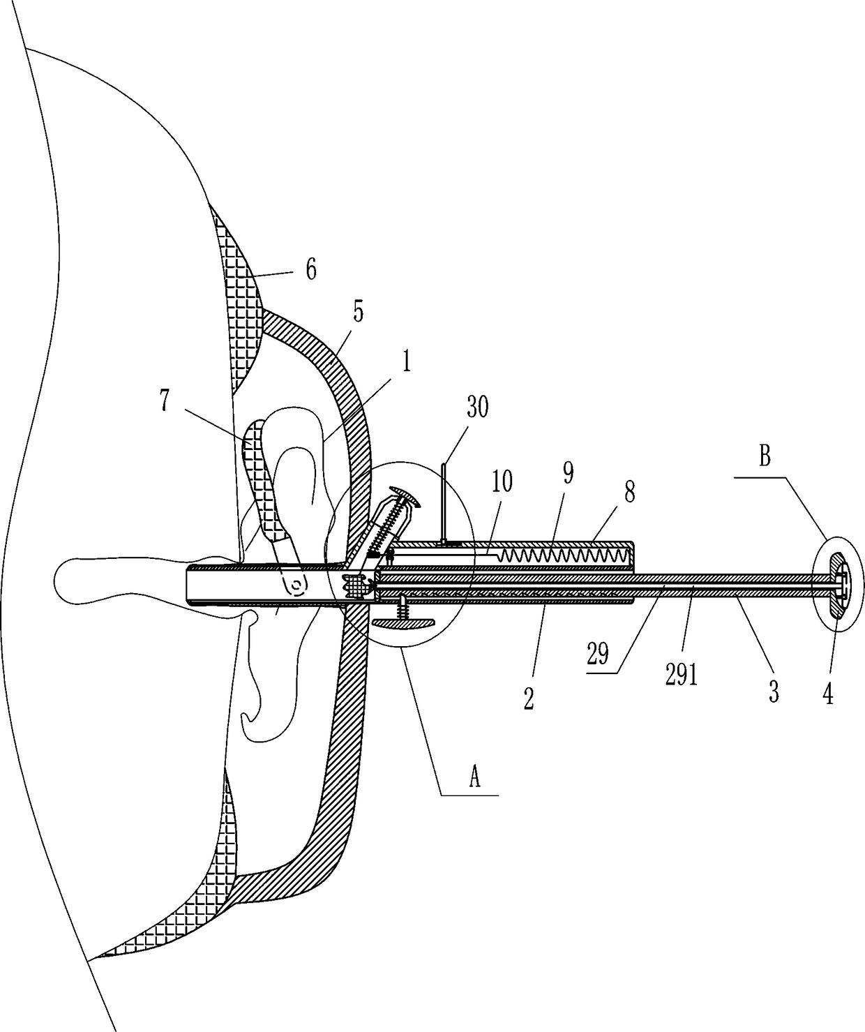 Absorbent cotton stuffing machine for otology