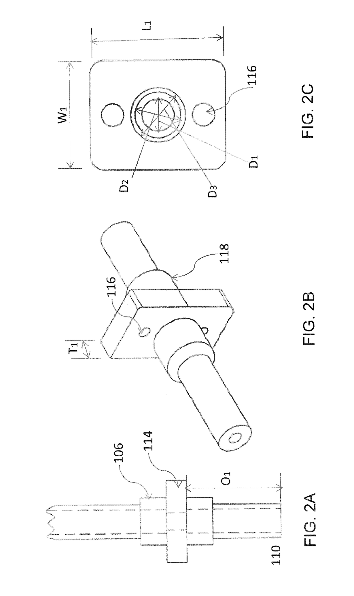Implant device for use in salivary gland duct