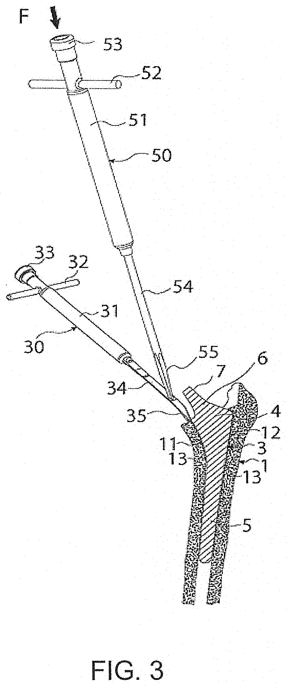 Thin-blade chisel system