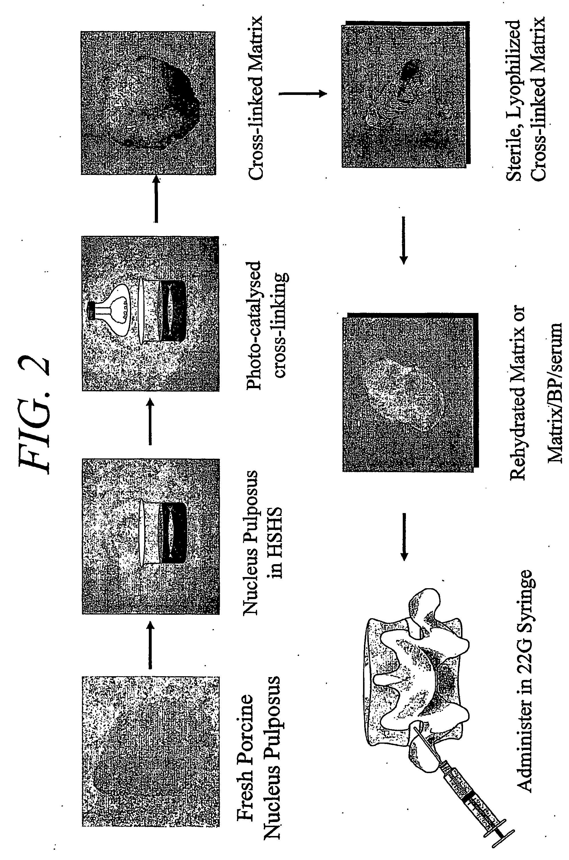 Hydrogel compositions comprising nucleus pulposus tissue