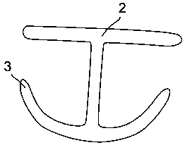 Anchor type bipolar electric cutting ring