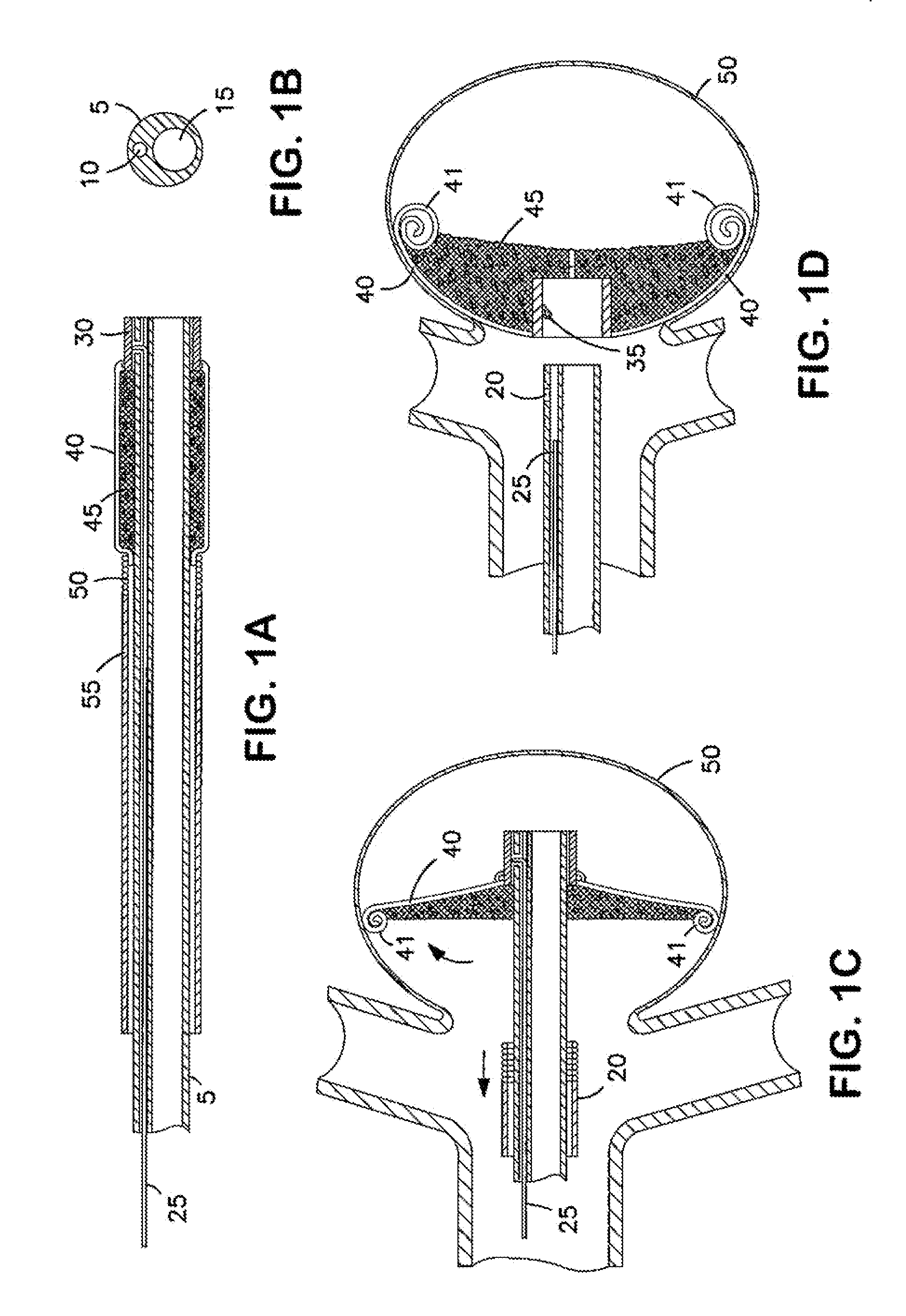 Aneurysm Occlusion Devices